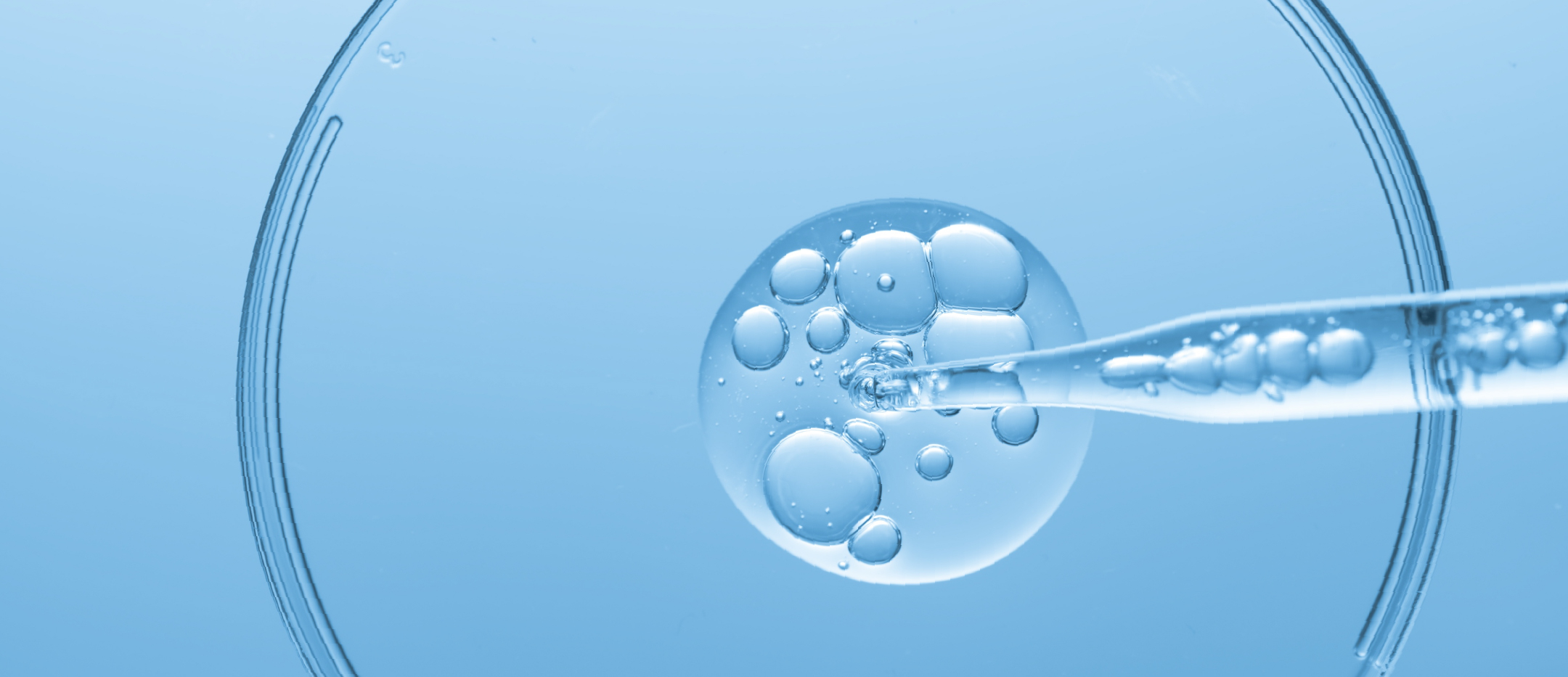 Gros plan sur une pipette contenant un gel transparent qui est l’acide hyaluronique utilisé en viscosupplémentation.